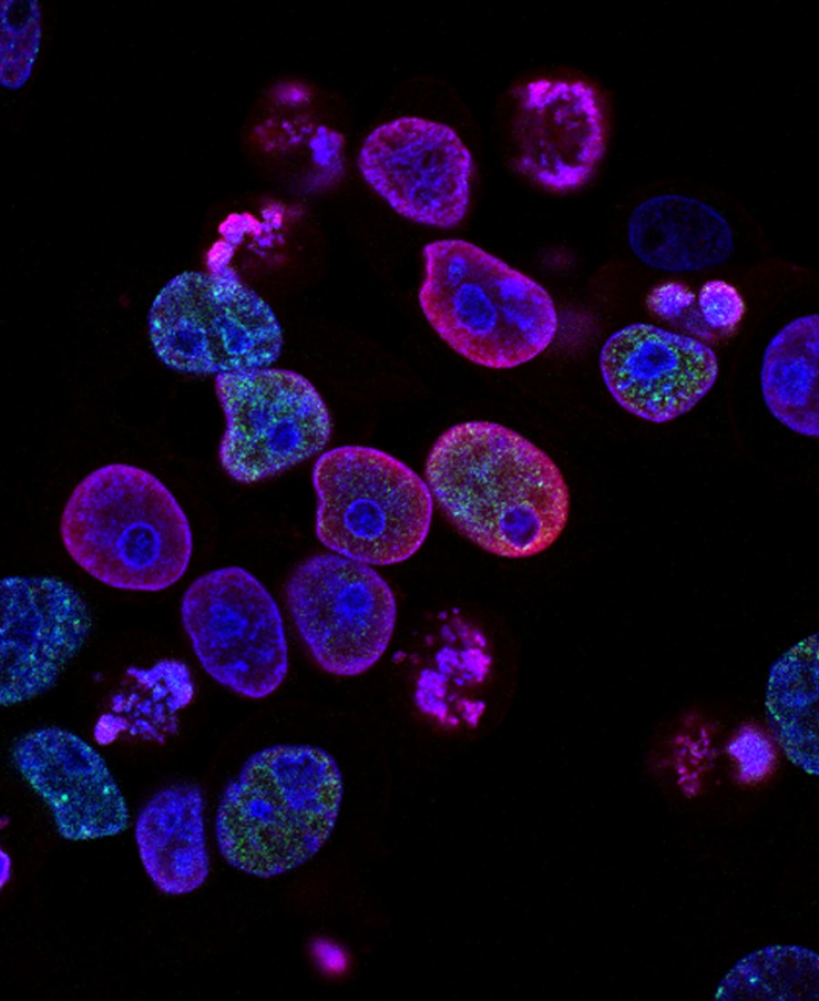 Epigenetic Reprogramming of the Tumour Microenvironment
